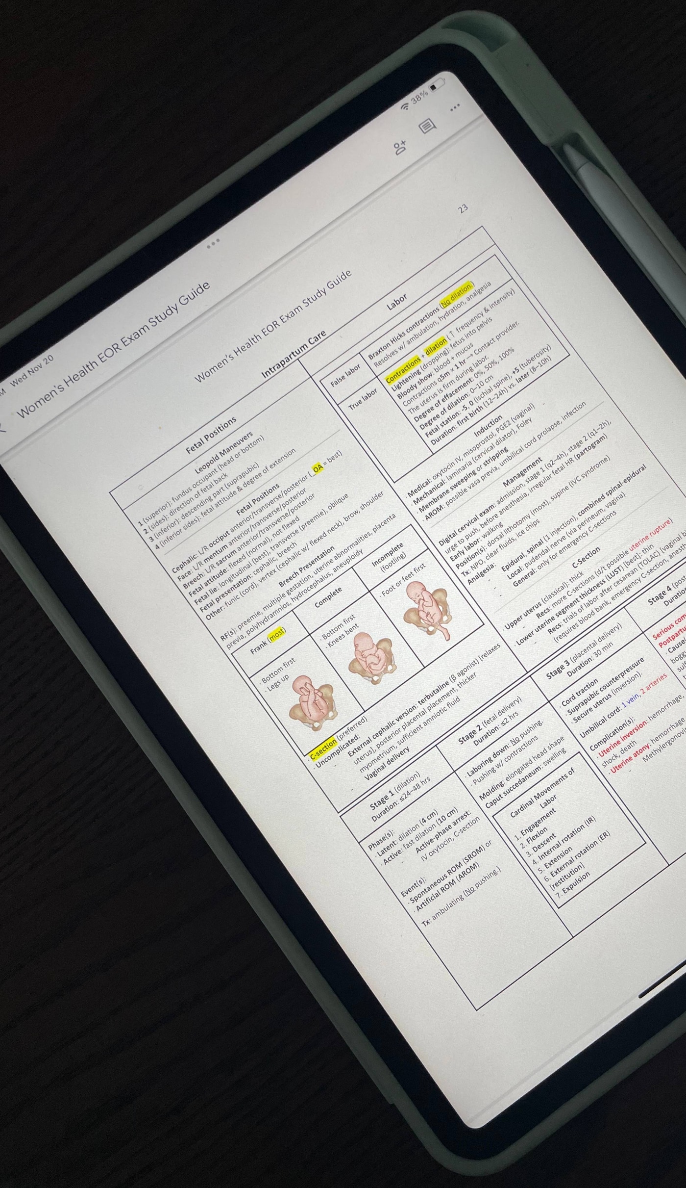 Women's Health EOR Study Guide